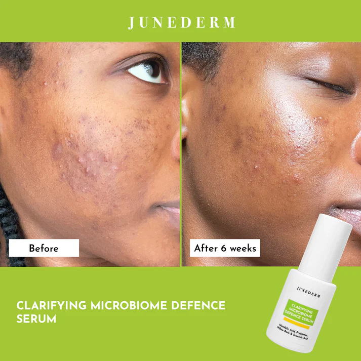 Junederm Clarifying Microbiome Defence Serum