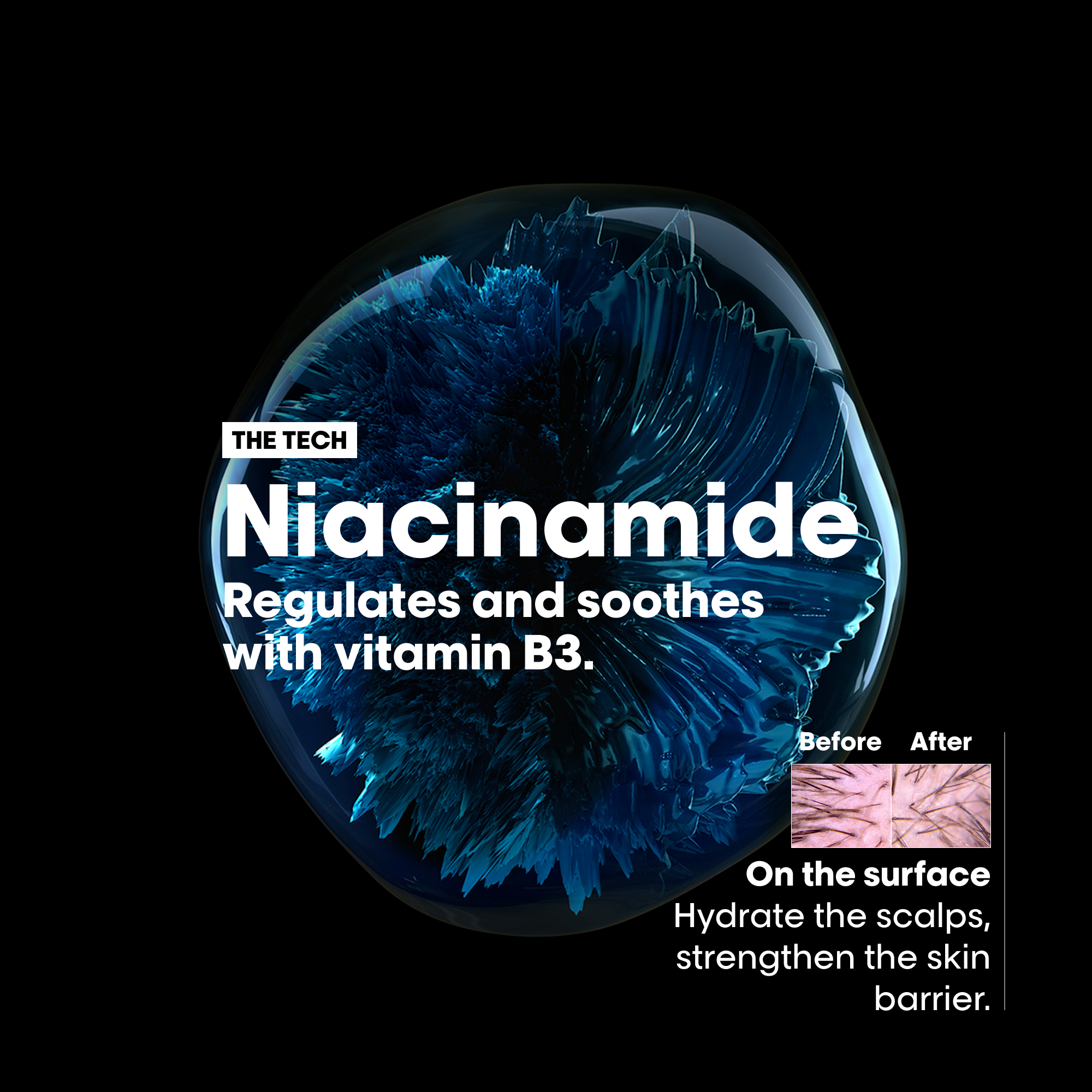 L’Oréal Professionnel Scalp Advanced Anti-Discomfort Dermo-Regulator Shampoo - Image 5